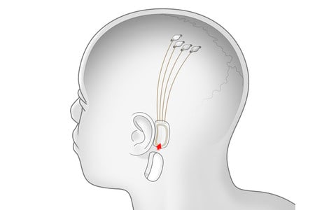 chip en cerebro