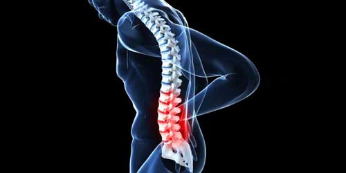 dolor en la columna vertebral